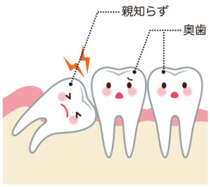 親知らず　矯正　難波矯正歯科